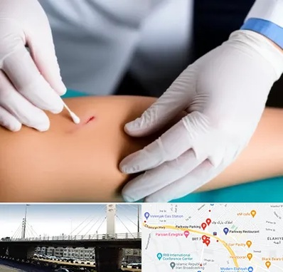 متخصص زخم عفونی در پارک وی 