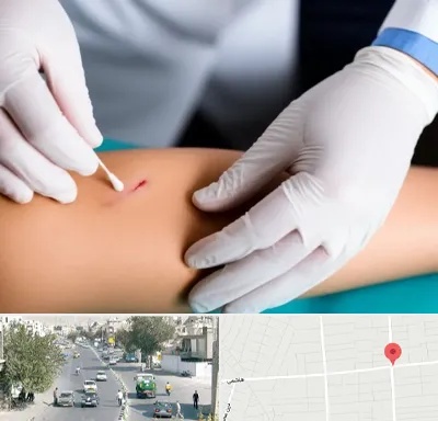 متخصص زخم عفونی در هاشمی