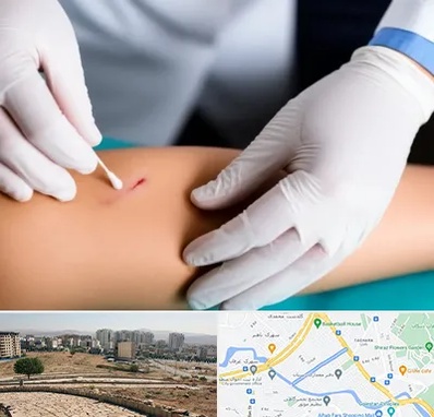 متخصص زخم عفونی در کوی وحدت شیراز 