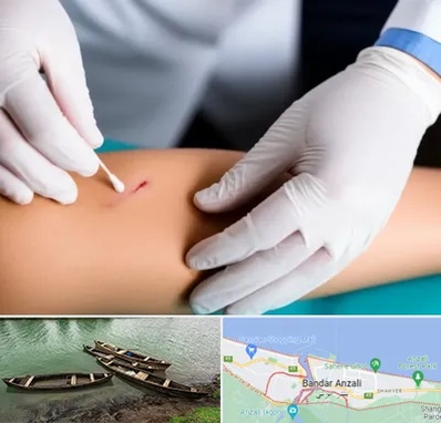 متخصص زخم عفونی در بندر انزلی