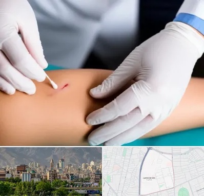 متخصص زخم عفونی در جمشیدیه 