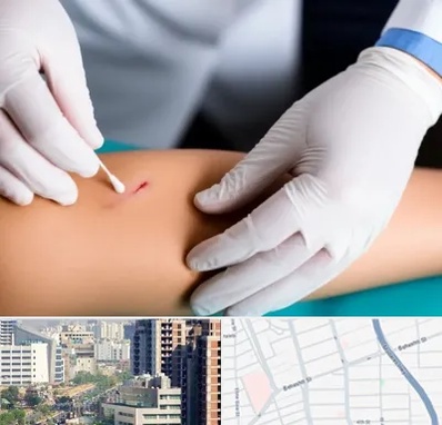 متخصص زخم عفونی در خیابان بهشتی