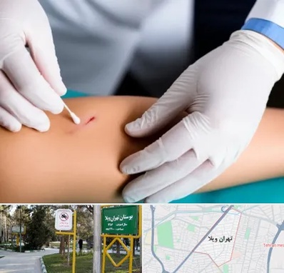 متخصص زخم عفونی در تهران ویلا