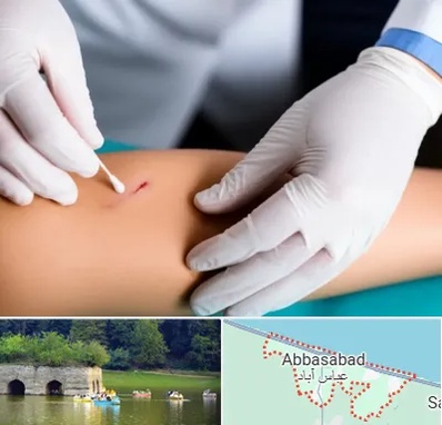 متخصص زخم عفونی در عباس آباد