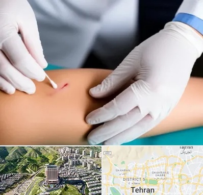 متخصص زخم عفونی در شمال تهران 