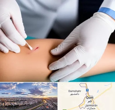 متخصص زخم عفونی در قم