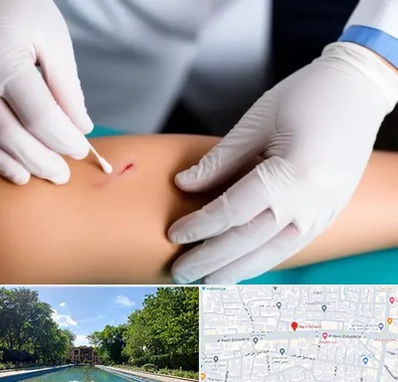 متخصص زخم عفونی در هشت بهشت اصفهان 