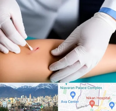 متخصص زخم عفونی در آجودانیه 