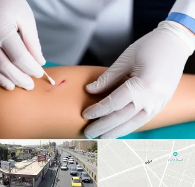 متخصص زخم عفونی در خیابان دماوند