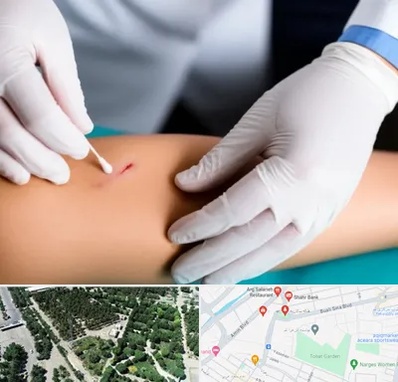 متخصص زخم عفونی در سالاریه قم 