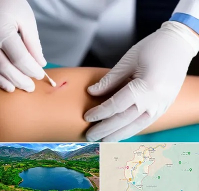 متخصص زخم عفونی در رودبار