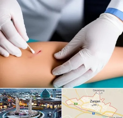 متخصص زخم عفونی در زنجان