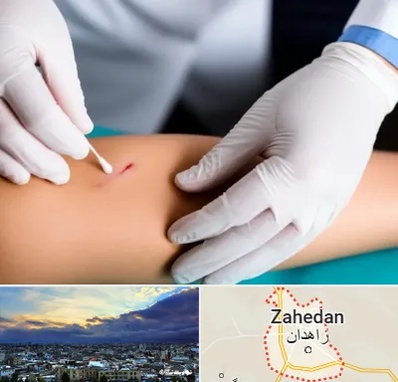 متخصص زخم عفونی در زاهدان