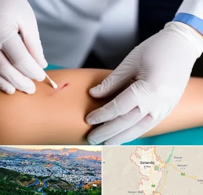 متخصص زخم عفونی در سنندج