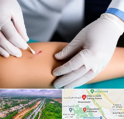 متخصص زخم عفونی در قصرالدشت شیراز 