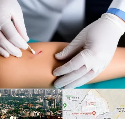 متخصص زخم عفونی در عظیمیه کرج 