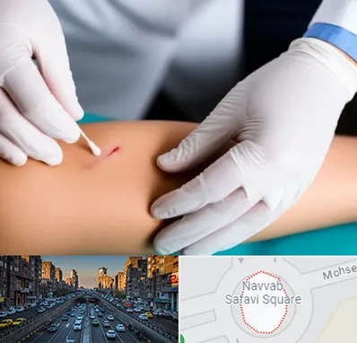 متخصص زخم عفونی در نواب 