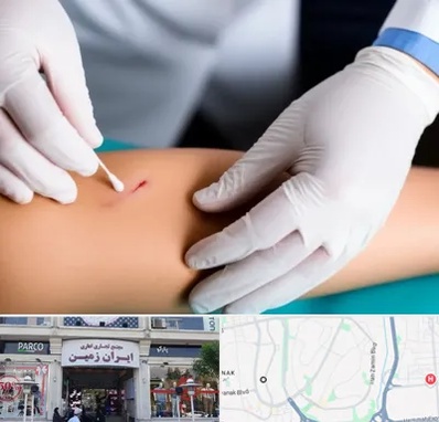 متخصص زخم عفونی در ایران زمین 