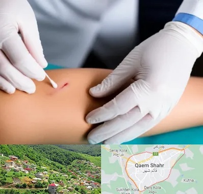 متخصص زخم عفونی در قائم شهر