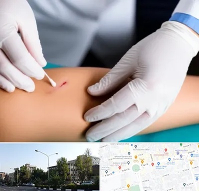 متخصص زخم عفونی در میدان کاج 