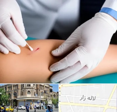 متخصص زخم عفونی در لاله زار