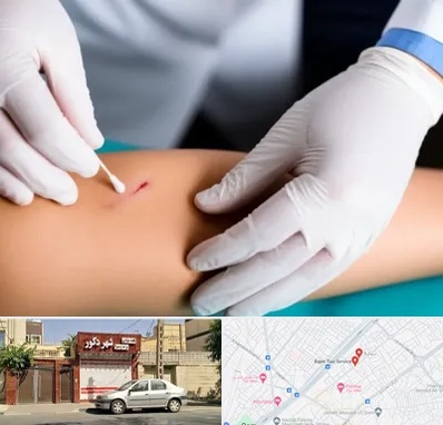 متخصص زخم عفونی در باجک قم 