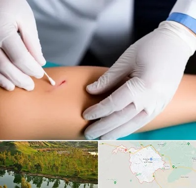 متخصص زخم عفونی در بهبهان