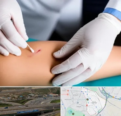 متخصص زخم عفونی در یاغچیان تبریز 