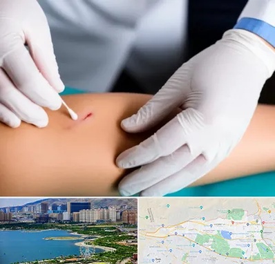 متخصص زخم عفونی در منطقه 22 تهران