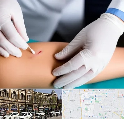 متخصص زخم عفونی در منطقه 11 تهران 