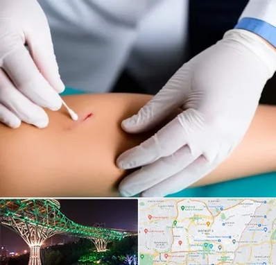 متخصص زخم عفونی در منطقه 3 تهران 