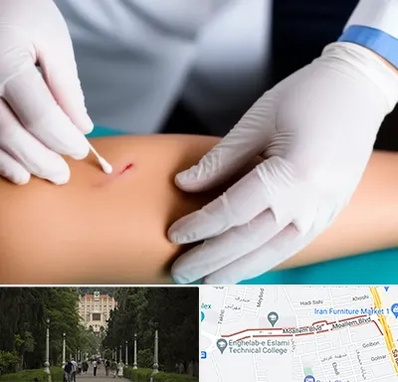 متخصص زخم عفونی در بلوار معلم رشت 