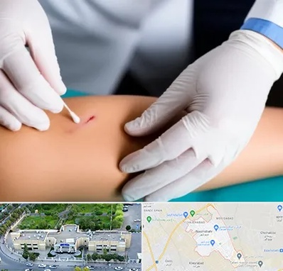 متخصص زخم عفونی در نسیم شهر