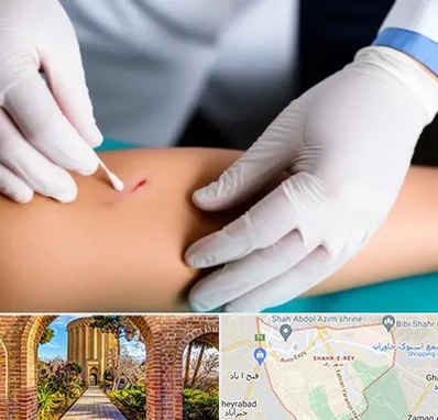 متخصص زخم عفونی در شهر ری