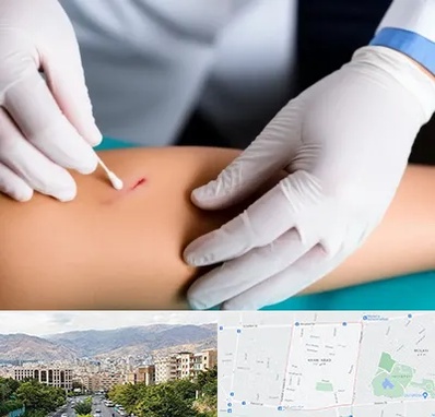 متخصص زخم عفونی در خانی آباد 