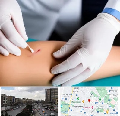 متخصص زخم عفونی در بلوار فردوسی مشهد 