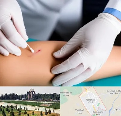 متخصص زخم عفونی در قرچک