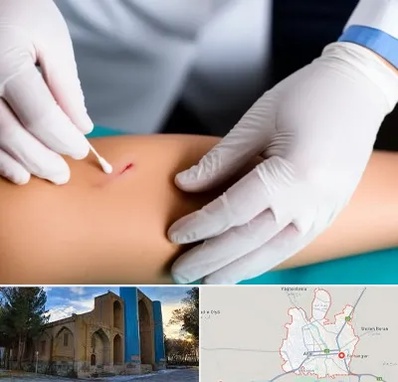 متخصص زخم عفونی در اهر