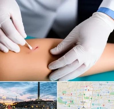 متخصص زخم عفونی در منطقه 2 تهران 