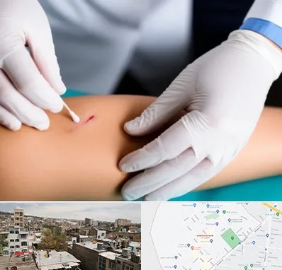 متخصص زخم عفونی در شمیران نو 