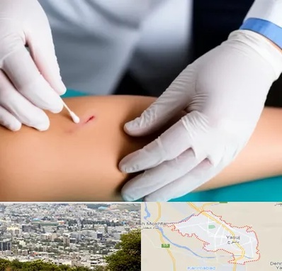 متخصص زخم عفونی در یاسوج