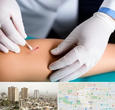 متخصص زخم عفونی در منطقه 5 تهران