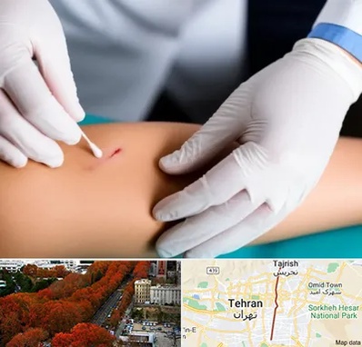 متخصص زخم عفونی در ولیعصر 