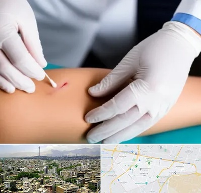 متخصص زخم عفونی در منطقه 8 تهران 