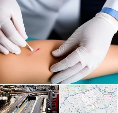 متخصص زخم عفونی در ستارخان شیراز 