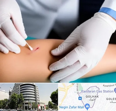 متخصص زخم عفونی در قلهک 