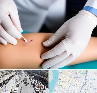 متخصص زخم عفونی در نادری اهواز 