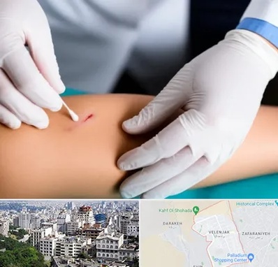 متخصص زخم عفونی در ولنجک 