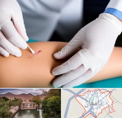 متخصص زخم عفونی در دامغان