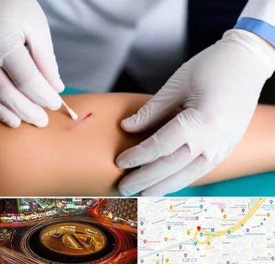 متخصص زخم عفونی در میدان ولیعصر 